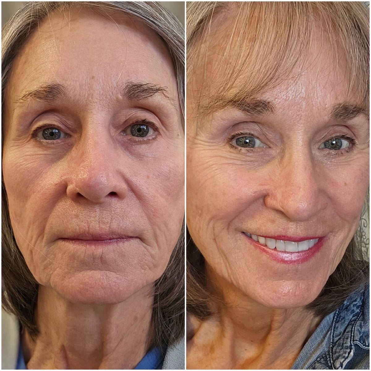 Woman feeling renewed after using CelluNAD+